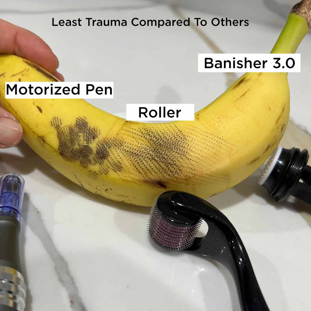 Banish Kit 3.0 - Image 4