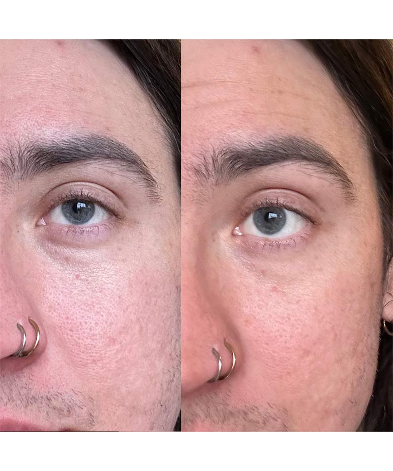 Depuffer Bundle - Instant Lift Brightening Eye Creme + Banisher Head - Image 3