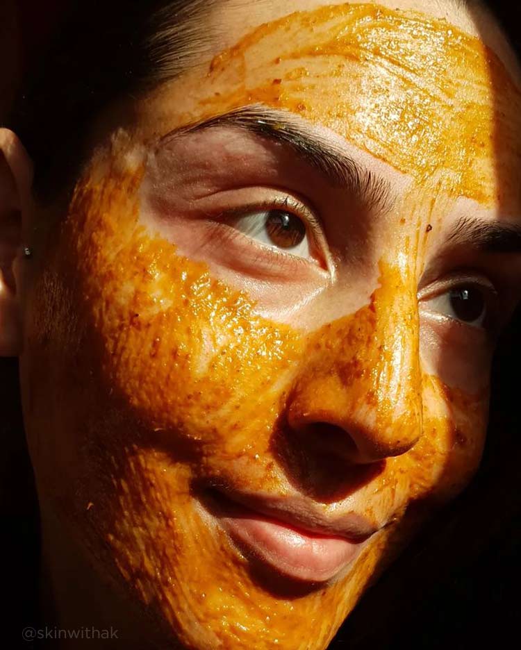 Scarring and Acne Kit - Image 4